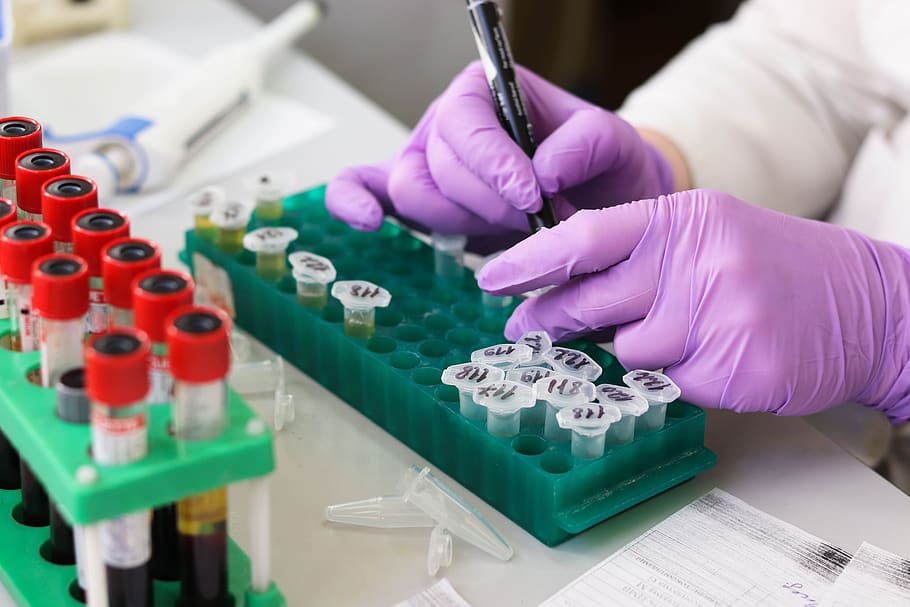Microbial Testing of Water, Food and Environment